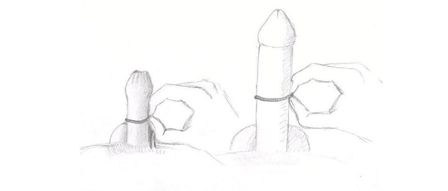 Messung der Dicke des Penis